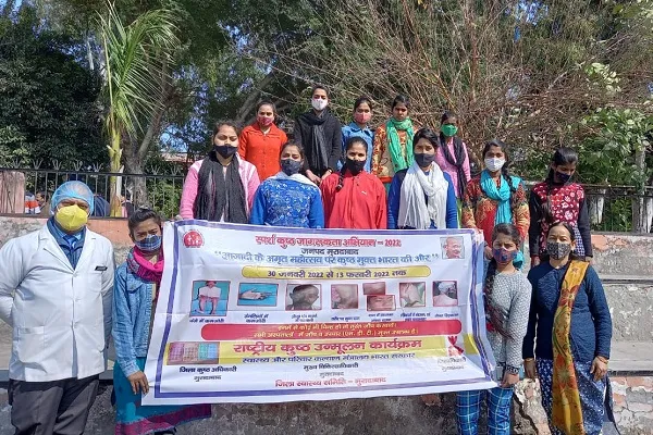 मुरादाबाद : मानव श्रृंखला बनाकर कुष्ठ रोग के प्रति किया जागरूक
