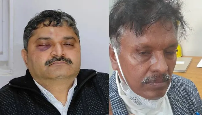 लखनऊ: बीबीएयू में शिक्षक और उप कुलसचिव के बीच हुई मारपीट, केस दर्ज