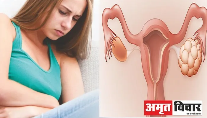 Health Tips: लड़कियों में तेजी से बढ़ रही PCOD की समस्या, जानें क्या है कारण और कैसे बरतें सावधानी