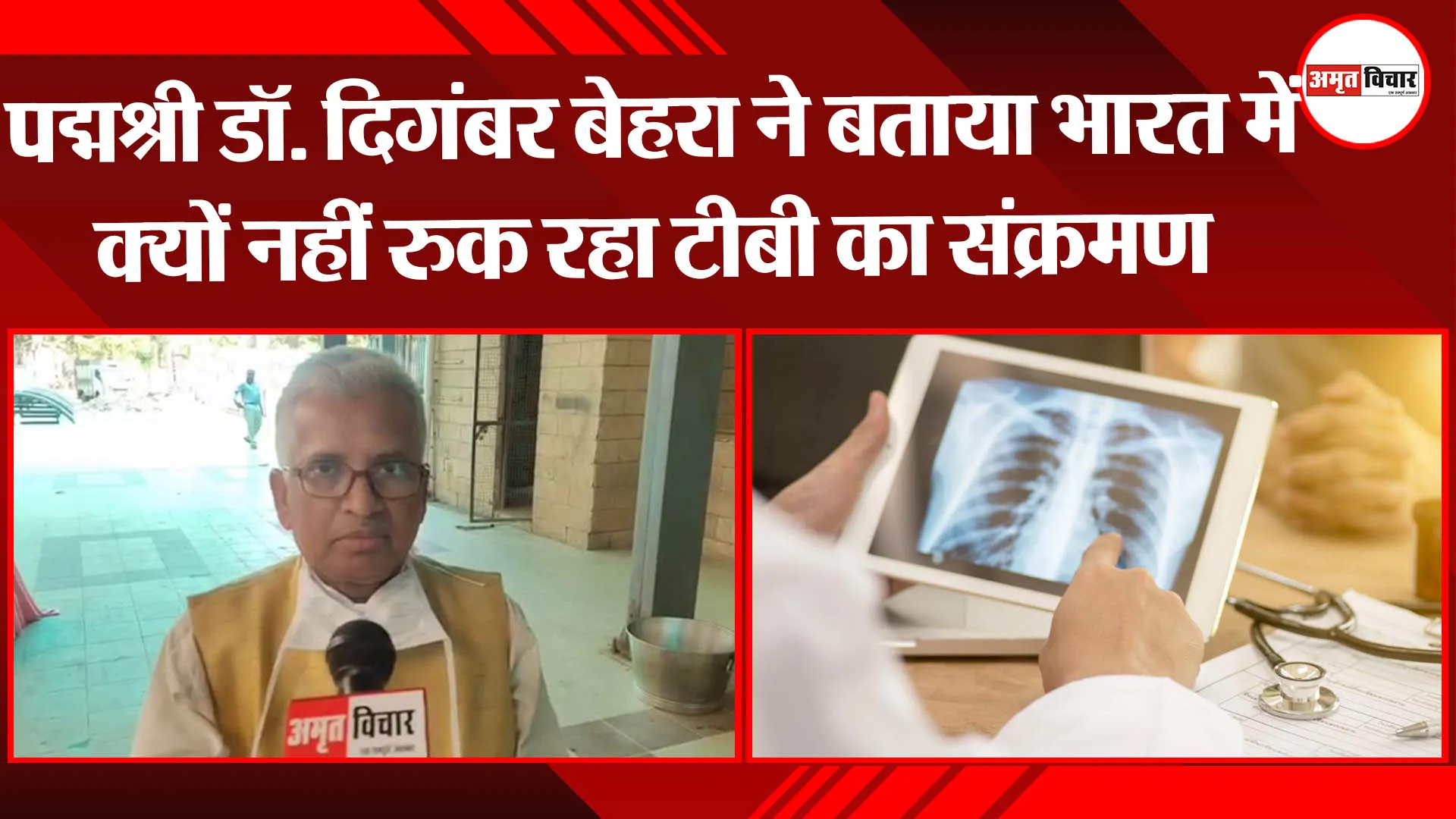 लखनऊ: पद्मश्री डॉ.दिगंबर बेहरा ने बताया भारत में क्यों नहीं रुक रहा टीबी का संक्रमण
