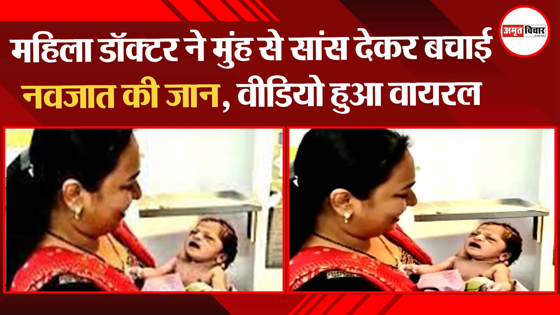 आगरा: महिला डॉक्टर ने मुंह से सांस देकर बचाई नवजात की जान, वीडियो हुआ वायरल