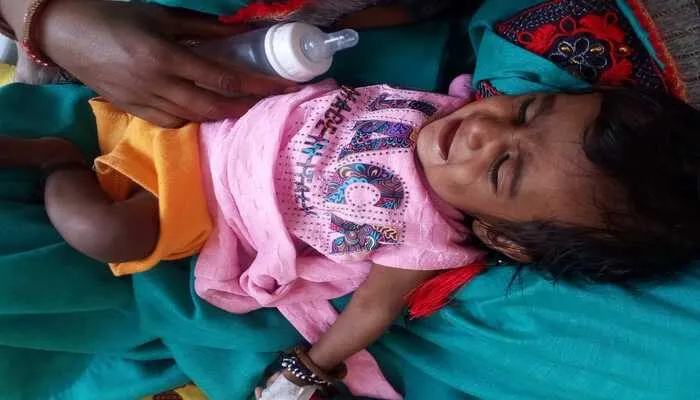 उन्नाव: गर्मी बढ़ते ही डायरिया व बुखार का हुआ हमला, 25 मरीज अस्पताल में भर्ती