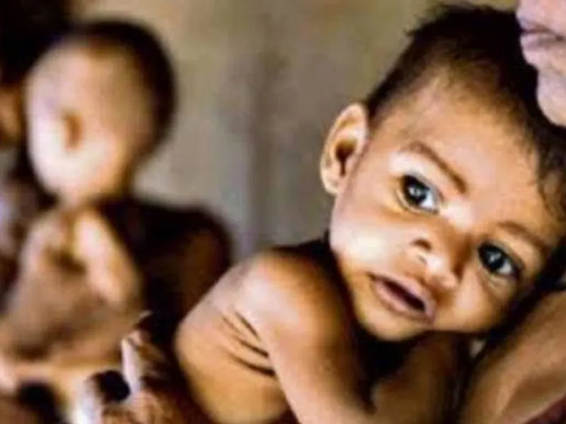 बरेली: गाय के दूध से कुपोषित बच्चों की सेहत का रखा जाएगा ध्यान