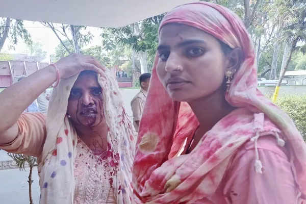 मुरादाबाद : पिता से मिलने आई बहन का भाई ने ईंट से फोड़ा सिर, बचाने आई दूसरी बहन को भी पीटा