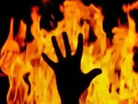 हल्द्वानी: चाय बनाते समय झुलसी महिला की इलाज के दौरान मौत