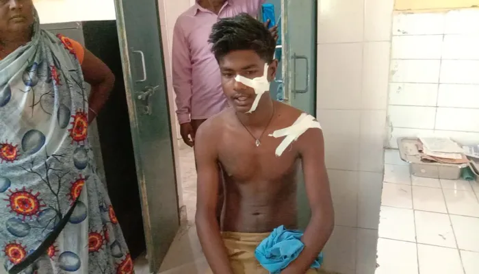 बहराइच: नित्य क्रिया के लिए गए युवक पर तेंदुए ने किया हमला, किया गया सीएचसी रेफर