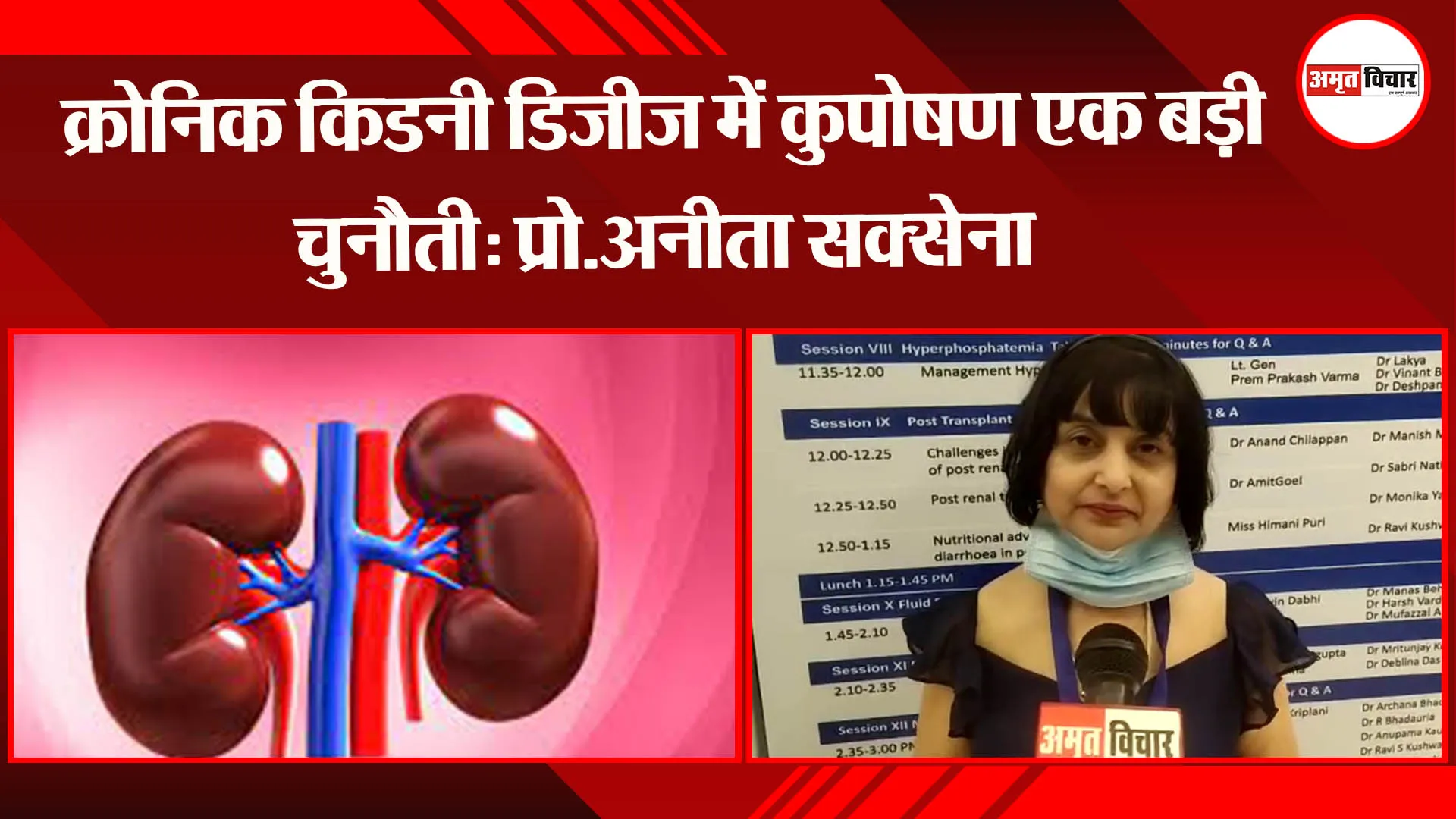 लखनऊ: क्रोनिक किडनी डिजीज में कुपोषण एक बड़ी चुनौती:प्रो.अनीता सक्सेना