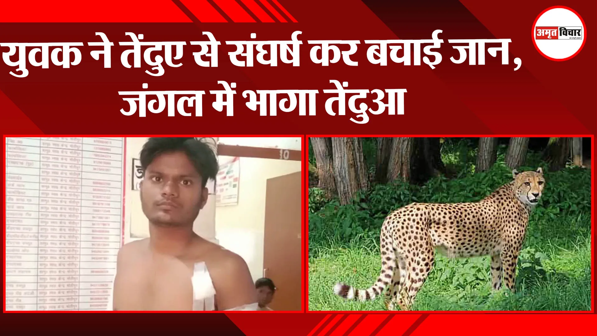 बहराइच: युवक ने तेंदुए से संघर्ष कर बचाई जान,जंगल में भागा तेंदुआ