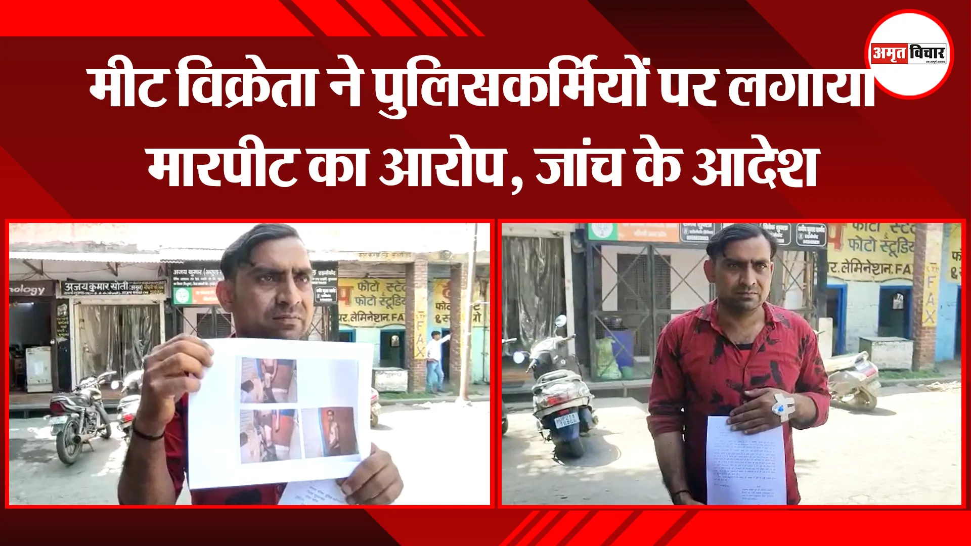 मुरादाबाद: मीट विक्रेता ने पुलिसकर्मियों पर लगाया मारपीट का आरोप, जांच के आदेश