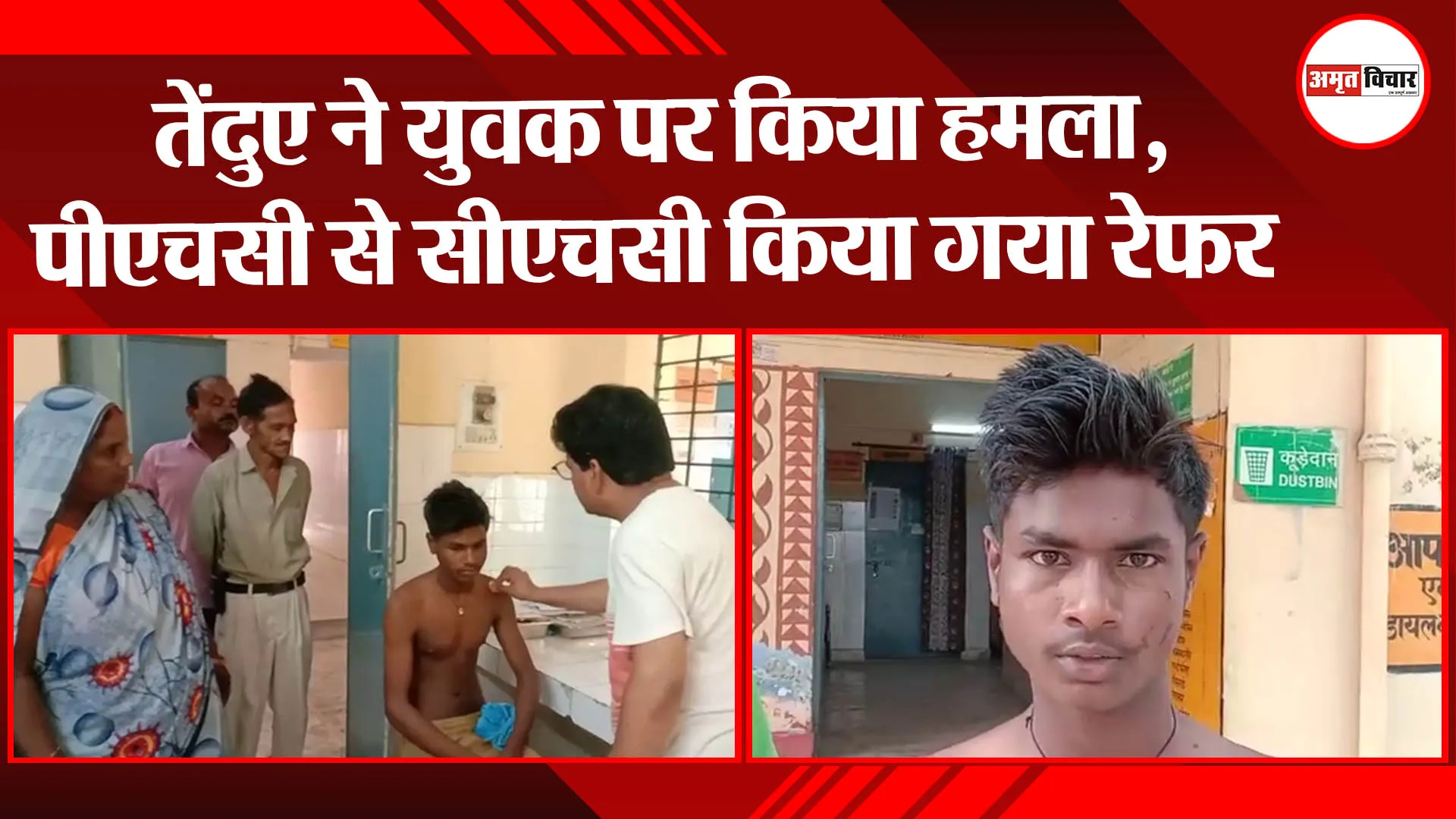 बहराइच: तेंदुए ने युवक पर किया हमला, पीएचसी से सीएचसी किया गया रेफर