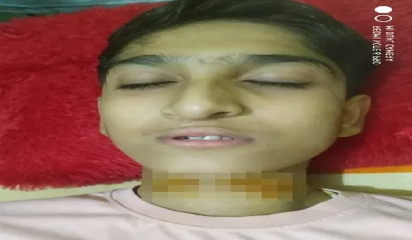 अमरोहा : चाइनीज मांझे से कटी छात्र की गर्दन, घायल