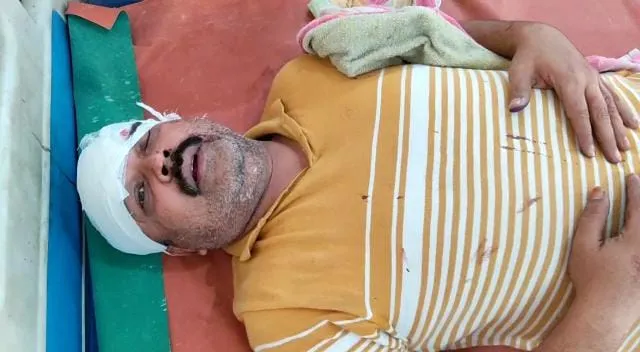 बरेली: मोदी को राम और योगी को कृष्ण बताया तो विरोधियों ने जमकर पीटा, गंभीर रूप से घायल