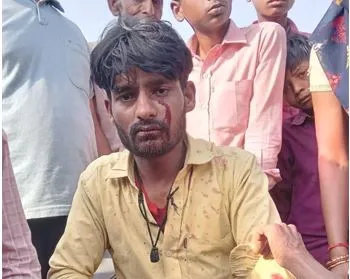 पीलीभीत: गन्ना छिलाई कर रहे मजदूर पर तेंदुए ने बोला हमला, जख्मी