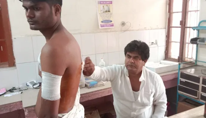 बहराइच: जान बचाने के लिये 15 मिनट तक तेंदुए से भिड़ा रहा युवक
