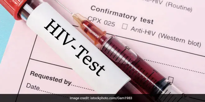 हल्द्वानी: तीन किशोरों में एड्स की पुष्टि