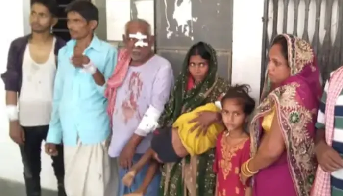 बलिया: पागल कुत्ते के काटने से 11 घायल, ग्रामीणों ने पीटकर उतारा मौत के घाट