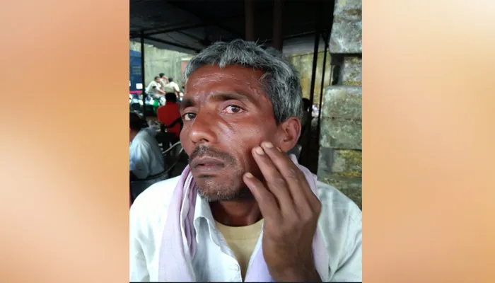 बहराइच: बिना रुपए के मजदूरी का विरोध करना पड़ा भारी, मालिक ने पुलिस से पिटवाया