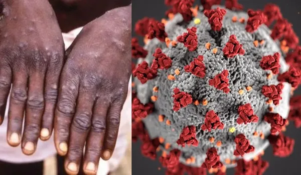 लैंसेट अध्ययन के अनुसार, कुछ एंटीवायरल दवाएं मंकीपॉक्स के लिए कारगर