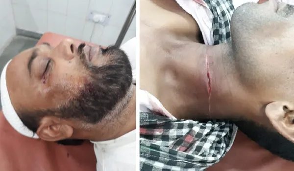 रामपुर : चाइनीज मांझे की चपेट में आकर दो लोग घायल, अस्पताल में भर्ती