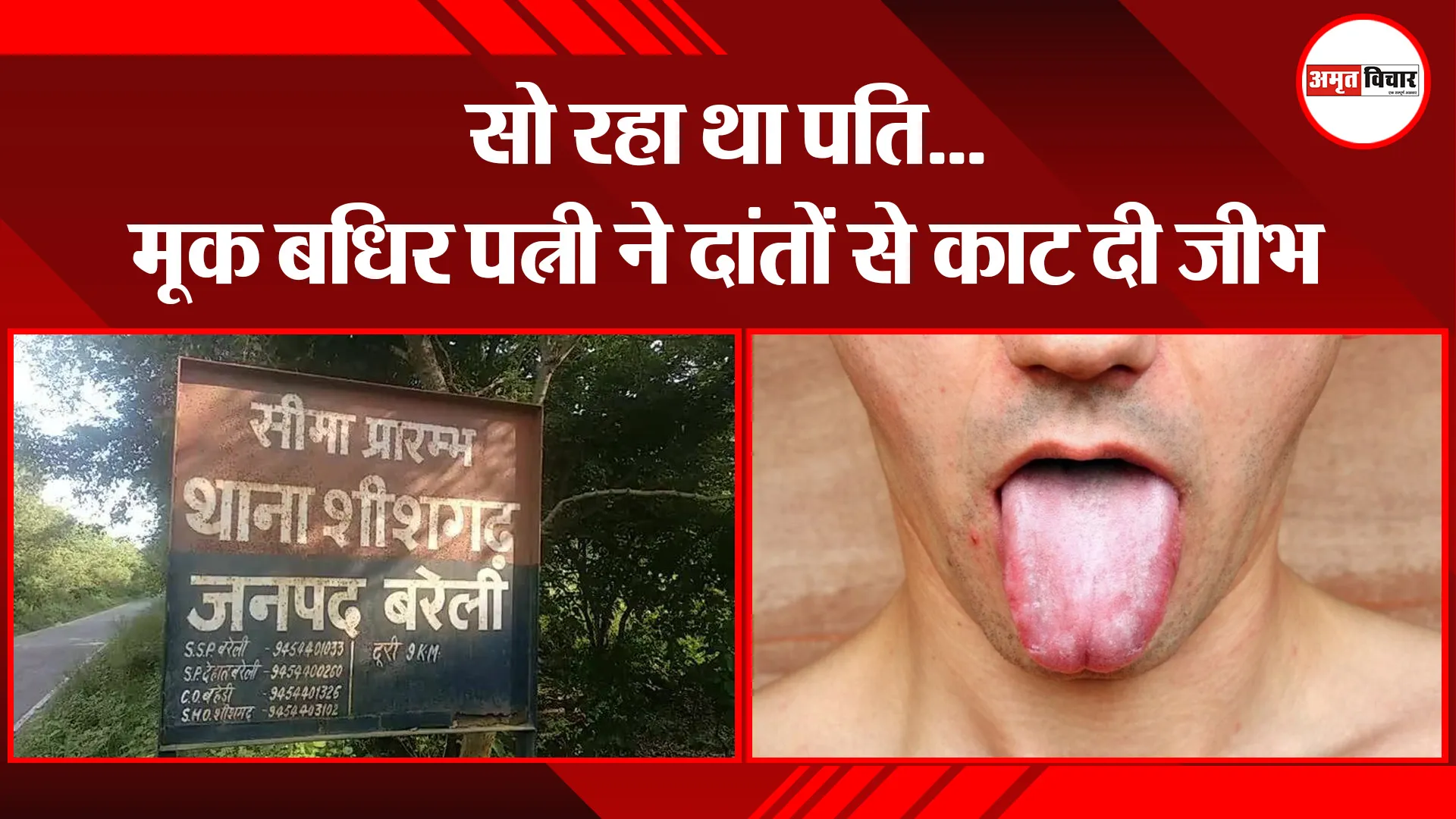 बरेली: सो रहा था पति…मूक बधिर पत्नी ने दांतों से काट दी जीभ
