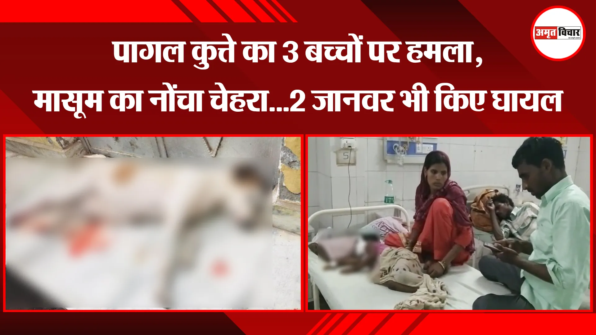 मुरादाबाद: पागल कुत्ते का 3 बच्चों पर हमला, मासूम का नोंचा चेहरा…2 जानवर भी किए घायल