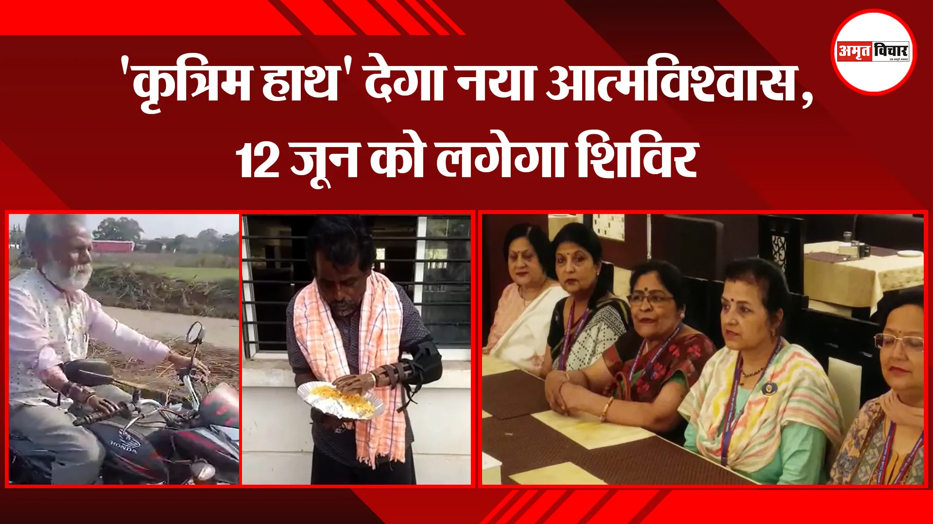 हल्द्वानी: ‘कृत्रिम हाथ’ देगा नया आत्मविश्वास, 12 जून को लगेगा शिविर