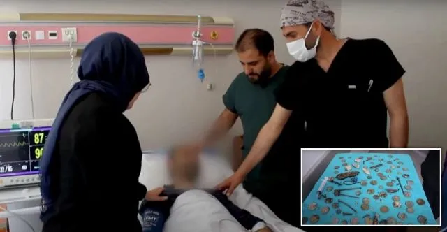 पेट में थे 233 सिक्के, बैटरी, चुंबक, कील और कांच के टुकड़े, फिर जो हुआ जानकर हो जाएंगे हैरान