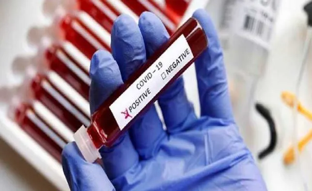 बरेली: कोरोना संक्रमण की बढ़ रही रफ्तार, घट रही सैंपलिंग