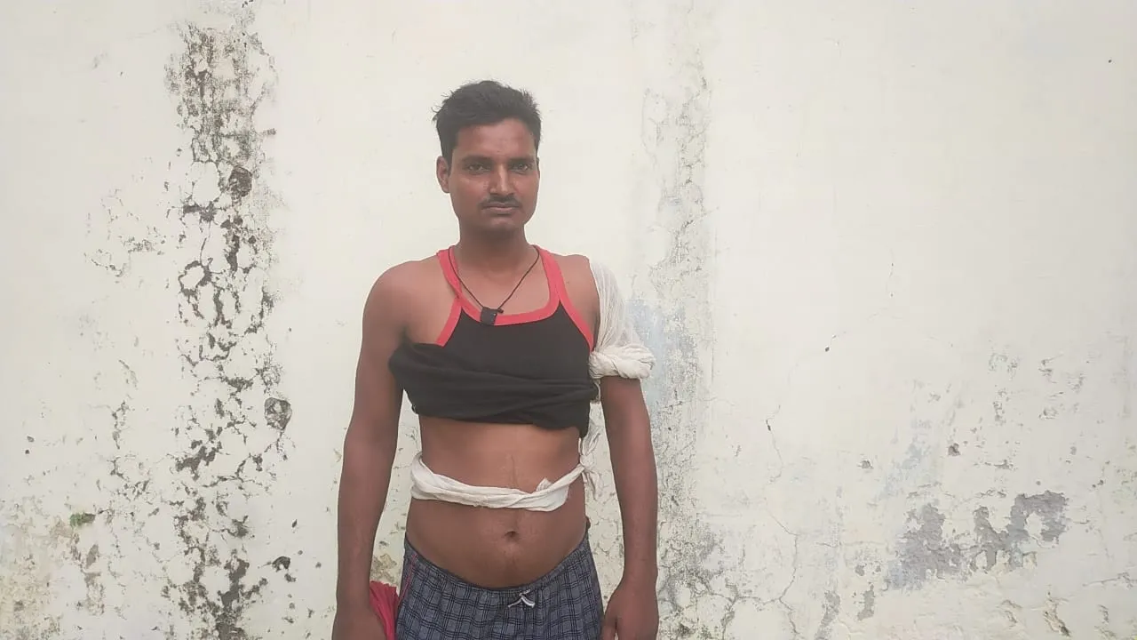 बहराइच : छत पर सो रहे युवक को बंदर ने नोचा, पहले भी कई ग्रामीणों को कर चुका है घायल