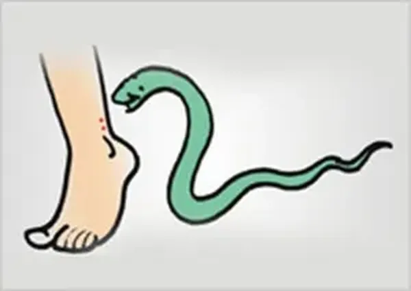 रुद्रपुर: सांप ने काटा, फिर भी वृद्धा ने नहीं हारी हिम्मत