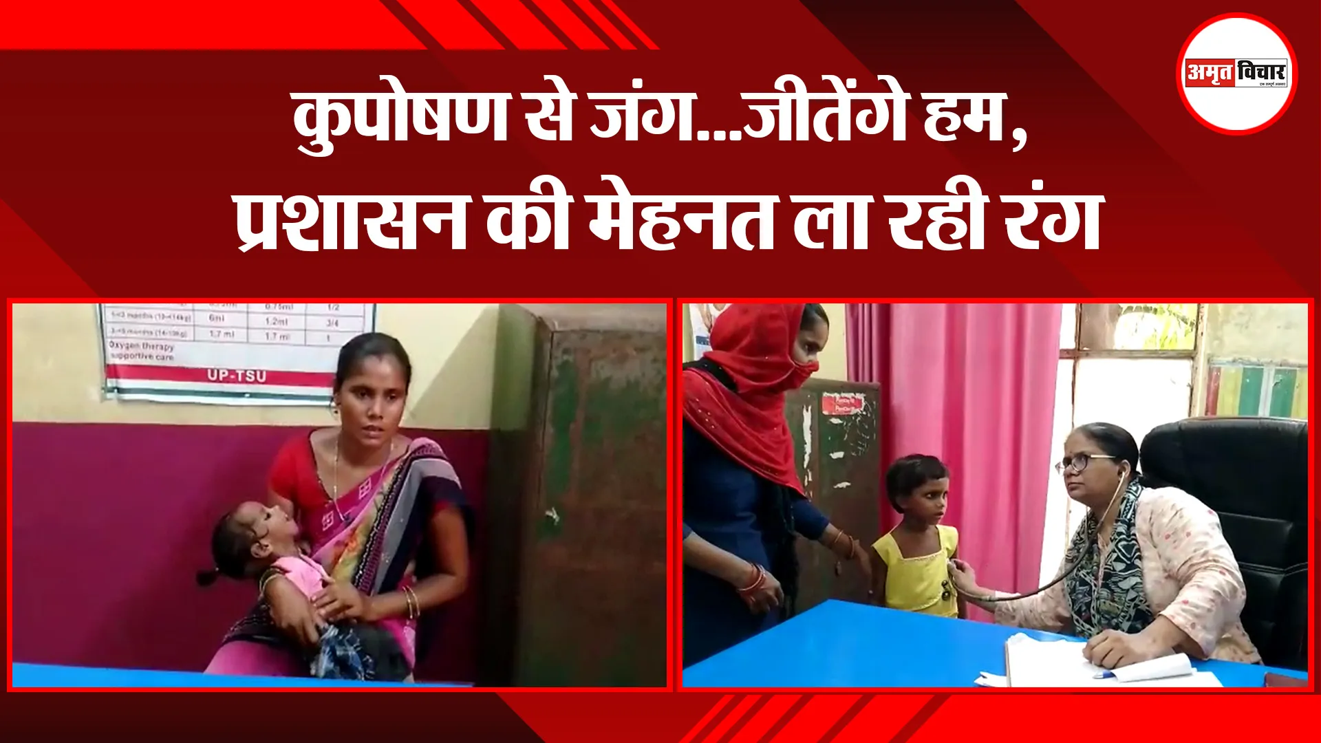 पीलीभीत: कुपोषण से जंग…जीतेंगे हम, प्रशासन की मेहनत ला रही रंग