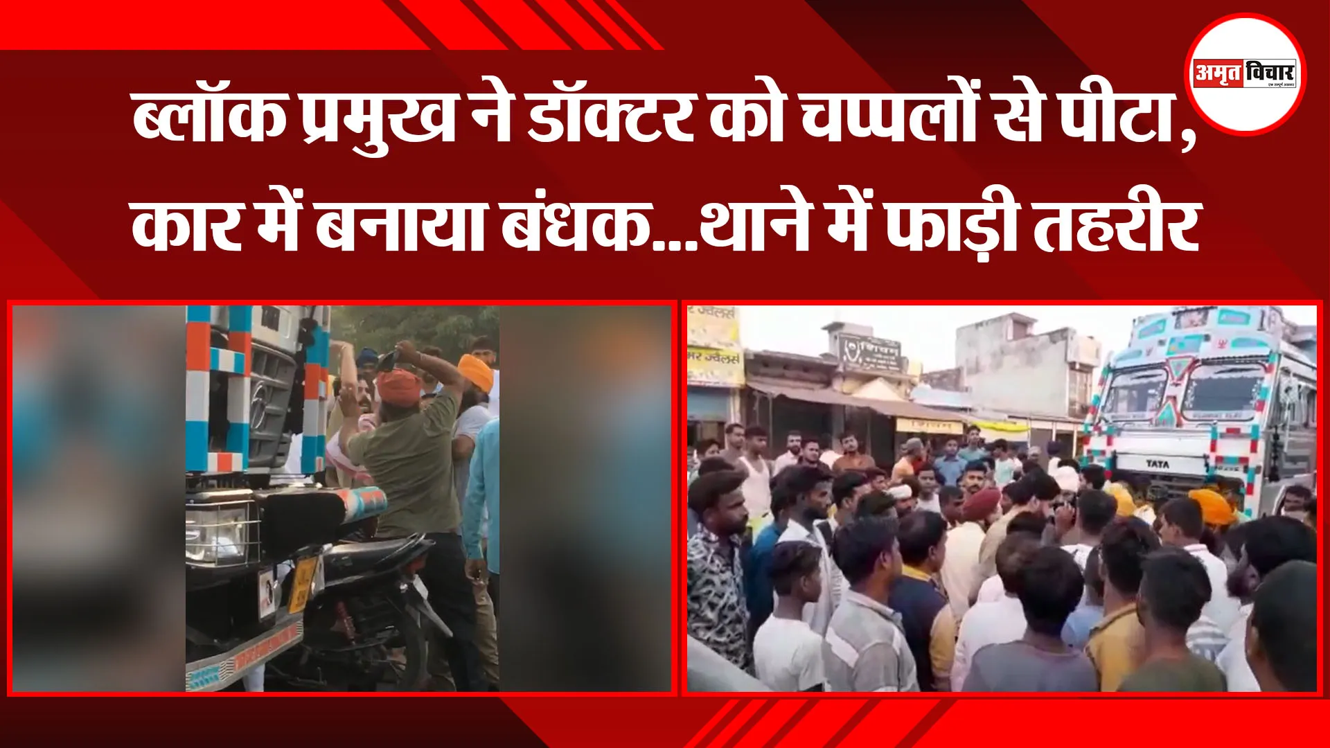 पीलीभीत: ब्लॉक प्रमुख ने डॉक्टर को चप्पलों से पीटा, कार में बनाया बंधक…थाने में फाड़ी तहरीर