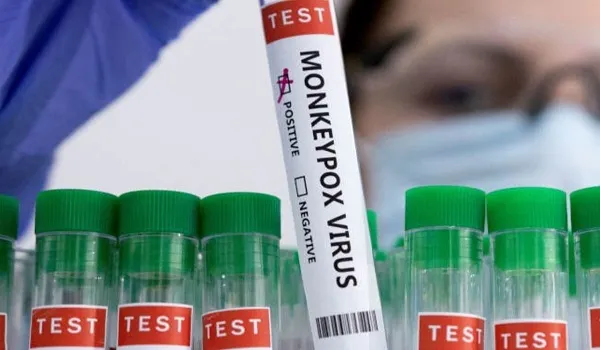 इन चार परिदृश्यों से समझिए, कैसे फैल सकती है मंकीपॉक्स महामारी