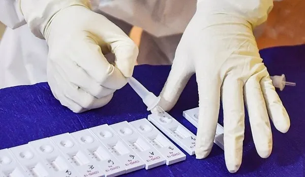 हांगकांग सरकार कोविड-19 वायरस का पता लगाने के लिए 190,000 आरएटी किट करेगी वितरित