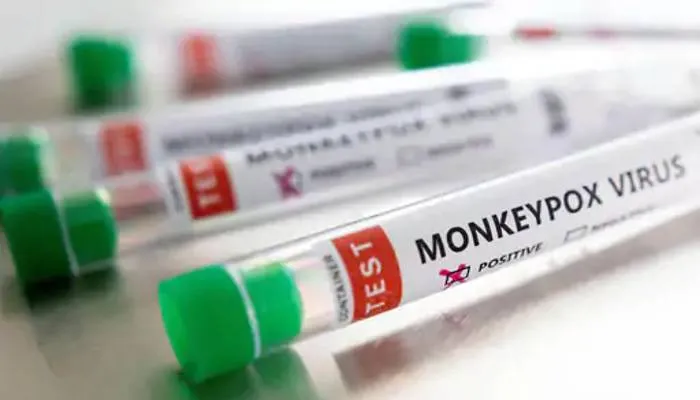 सावधान: Monkeypox से बच्चों को ज्यादा खतरा, लक्षणों पर रखनी होगी कड़ी नजर
