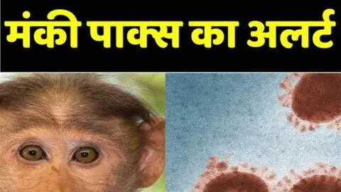 केरल में मंकी पॉक्स का केस, नैनीताल में अलर्ट