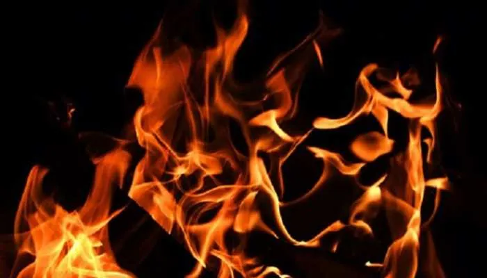 बहराइच: आग लगने से युवक समेत दो झुलसे, एक गंभीर