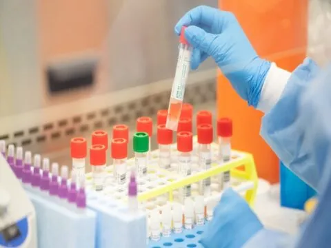 अल्मोड़ा में सैंपल लिए बगैर मरीज को थमा दी यूरिन रिपोर्ट, पैथोलॉजी लैब की खुली पोल
