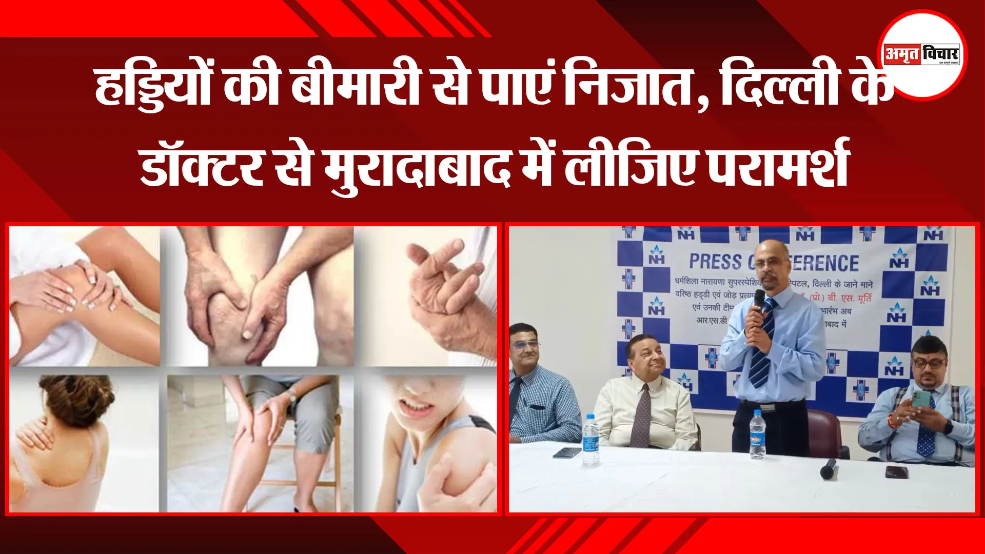 मुरादाबाद: हड्डियों की बीमारी से पाएं निजात, दिल्ली के डॉक्टर से मुरादाबाद में लीजिए परामर्श
