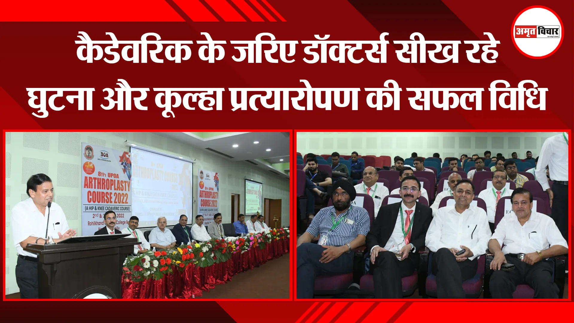 बरेली: कैडेवरिक के जरिए डॉक्टर्स सीख रहे घुटना और कूल्हा प्रत्यारोपण की सफल विधि
