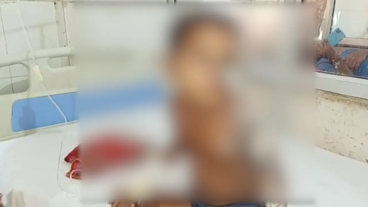 बरेली: खेलते-खेलते गर्म पानी में गिरी तीन साल की बच्ची, हालत नाजुक