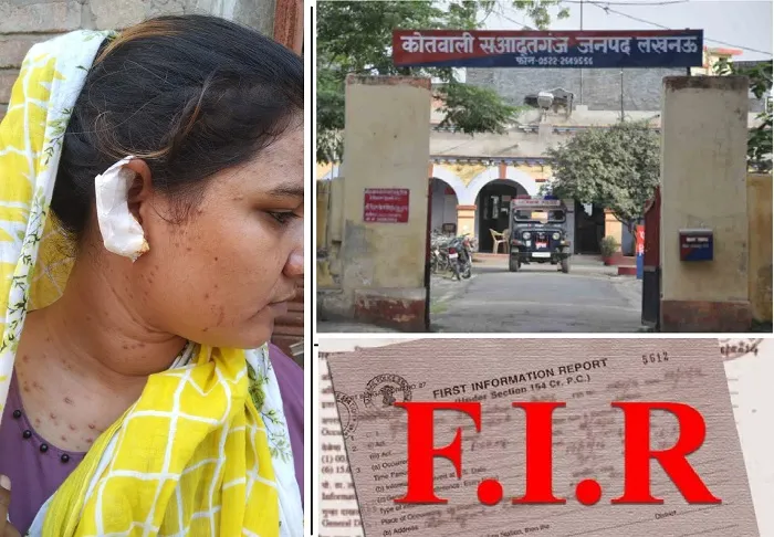लखनऊ : बच्चों के झगड़े में पड़ोसी ने महिला का काटा कान…जानें आगे