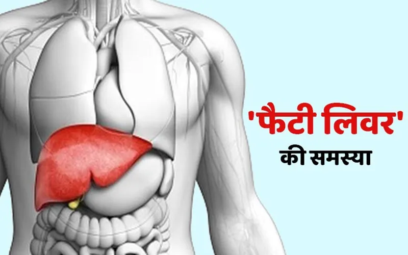 क्या आप फैटी लीवर की समस्या से हैं परेशान? जानें- क्या खाएं और क्या नहीं