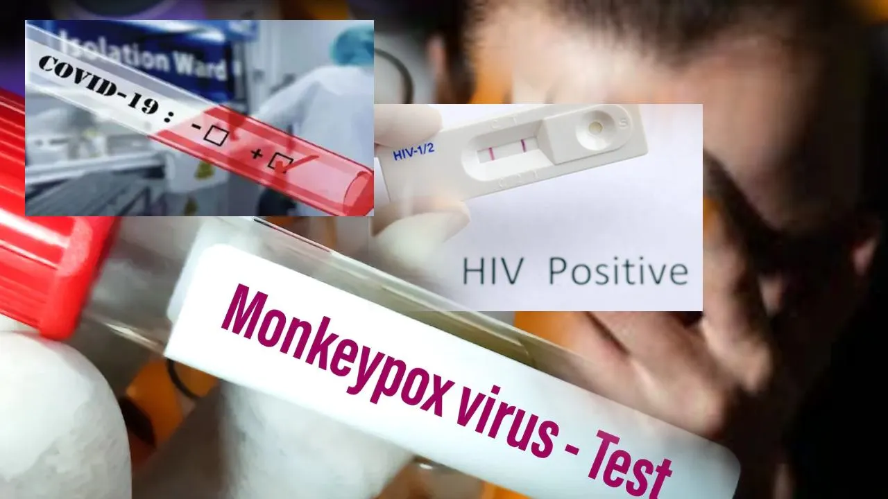 हायो रब्‍बा! इटली में शख्स को एक साथ हुआ HIV, Covid और Monkeypox