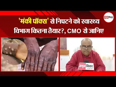 मथुरा: ‘मंकी पॉक्स’ से निपटने को स्वास्थ्य विभाग कितना तैयार?, CMO से जानिए