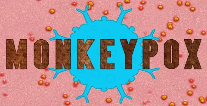 Monkeypox: नाइजीरियाई महिला निकली पॉजिटिव, देश में संक्रमितों की संख्या नौ पहुंचीं