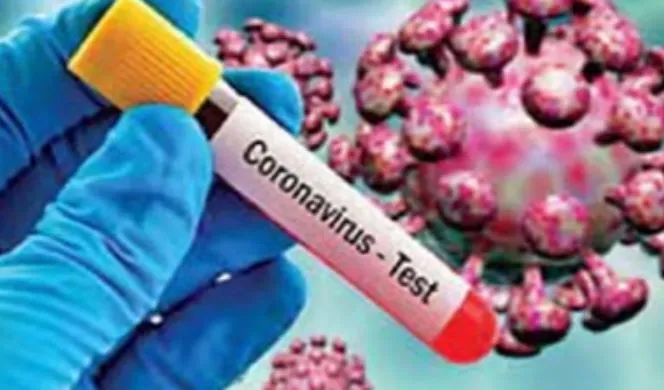 बरेली: कोरोना जांचें कम होने पर शासन ने जताई नाराजगी, ग्राफ बढ़ाएगी एमएमयू