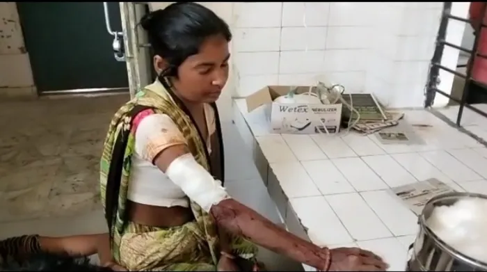 बहराइच : घर में सो रही महिला पर जंगली जीव का हमला, भर्ती