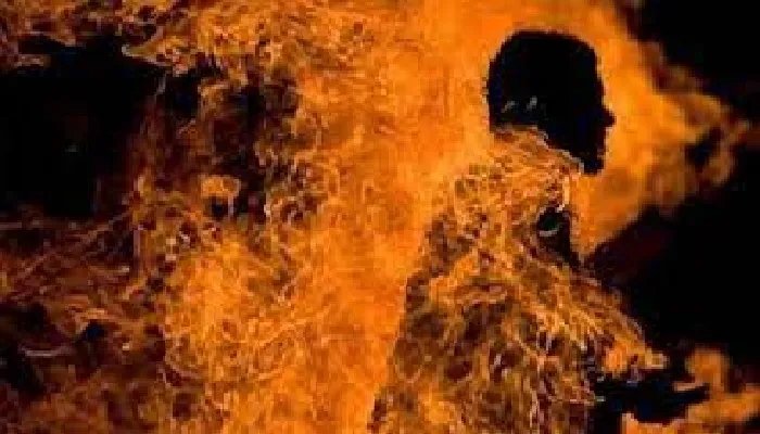 लखनऊ: मीशो कर्मी को जिंदा जलाया, हालत नाजुक