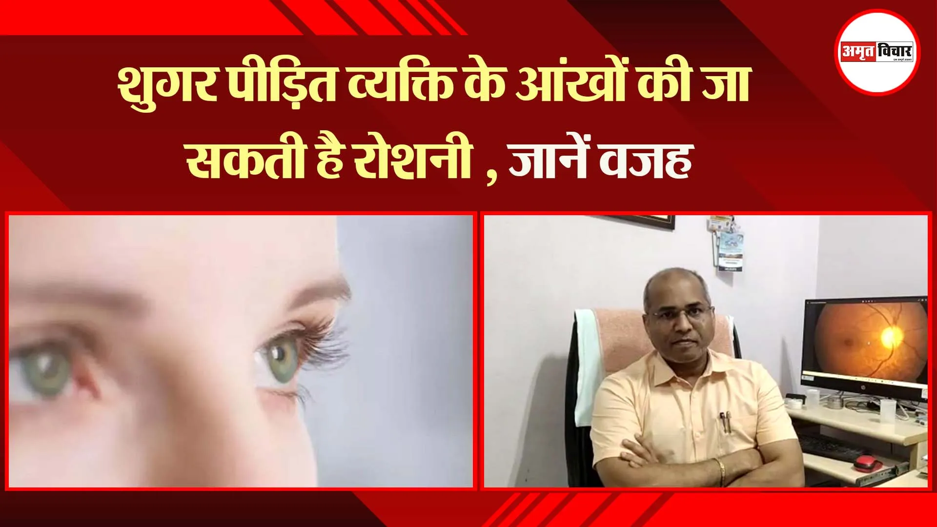 लखनऊ: शुगर पीड़ित व्यक्ति के आंखों की जा सकती है रोशनी , जानें वजह